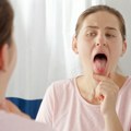 Dva manje poznata simptoma dijabetesa mogu da se primete u ustima