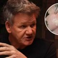 Unosio strah i trepet u svaku kuhinju, sad vodi tešku bitku: Gordon Remzi pokazao sliku nakon operacije tumora