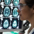 Šta leči neurolog i kada je vreme za pregled?
