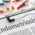 Proboj u medicini: Jednostavan test krvi mogao bi da ubrza otkrivanje endometrioze