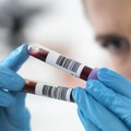 Medicina: Novi test krvi može da pokaže koliko brzo nam stare unutrašnji organi, kažu naučnici