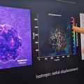 Nova nada za lečenje steriliteta: Naučnici prvi put snimili kako se ljudski embrion usađuje u matericu (VIDEO)