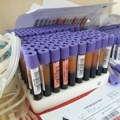 Rezultati biohemijskih analiza sa prošlonedeljnih preventivnih pregleda dostupni u OB Pirot i domovima zdravlja u Okrugu