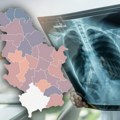 Jeziva mapa: U ovim delovima Srbije ima najviše obolelih od karcinoma, a evo koje tri vrste raka ima najviše pacijenata