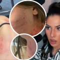 Sutra izricanje presude zetu UKI Q: Žena ga optužila za brutalno nasilje: "Udarao me je dok se nisam onesvestila"