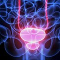 Rak prostate: Koji su simptomi i kako se leči