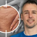 Problem koji muči čak 6 od 7 žena, a ne zaobilazi ni muškarce: Fitnes trener otkriva jedinu pravu formulu protiv celulita