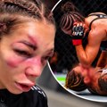 Uznemirujuće! Sofiji je lice unakaženo! Posle krvavog UFC debija pokazala jezive posledice – prizor nije za one sa slabijim…