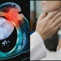 Srbija je treća zemlja u Evropi po stopi obolevanja od ove vrste raka: Pacijenti ostaju zauvek bez glasa