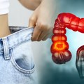 Koliki gubitak kilograma može da bude znak raka debelog creva