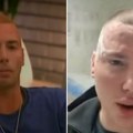 "Doktori su me upropastili, samo hoće novac": Brendon progovorio o operacijama, za par godina postao drugi čovek