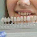 Celijakija i zubna gleđ: Uticaj autoimune bolesti na oralno zdravlje
