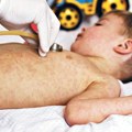 Da li su dečje bolesti bezazlene: Poznata doktorka govori o boginjama, zauškama i mmr vakcini, ali i kad nastaje sterilitet
