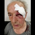 Saslušan muškarac koji je pretukao generala u penziji: Trojica napadača ga krvnički tukla pesnicama na autobuskoj stanici…