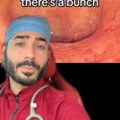 Doktor pokazao kako izgleda bolesno debelo crevo: 4 miliona ljudi šokirano gleda snimak od kog se želudac prevrće! (video)