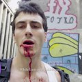 Policijsko žmurenje na nasilje u Pionirskom parku