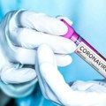 Francuska Akademija medicine pozvala na vakcinaciju protiv korona virusa
