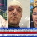 (Foto) Prva slika pretučenog Zorana Marjanovića: Oko mu je skroz zatvoreno, glava u zavojima, lice puno podliva