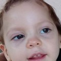 Mala Jovana vodi veliku životnu bitku: Pošalji SMS 334 na 2407