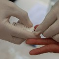 Ostrvska zemlja na udaru HIV-a: Proglašeno vanredno stanje, stručnjaci upozoravaju na godine krize