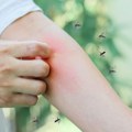 Dva slučaja groznice Zapadnog Nila potvrđena u Skoplju