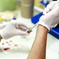 "Rana dijagnoza je presudna": Skoro 1.200 ljudu u Srbiji ne zna da je zaraženo HIV-om, kako na vreme to otkriti?