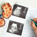 Kako prepoznati rak bubrega? Stručnjak upozorava na faktore rizika i savetuje najbolje korake prevencije
