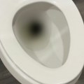 Noćna mora u sopstvenoj kući! Pogledala u WC šolju i zanemela - zbog jezivog stvorenja završila u bolnici (video)