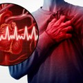 U Srbiji dnevno umre oko 140 ljudi od kardiovaskularnih bolesti