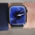 Apple Watch više nije samo obični, pametni sat