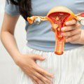 Endometrioza može godinama ostati neprepoznata: Evo koji su simptomi, dijagnostika i mogućnosti lečenja