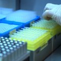 Trkulja: Ulaganje u lekove najmanje u Evropi, više od 80 inovativnih čeka ulaz na pozitivnu listu