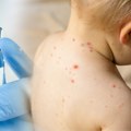 U Sarajevu proglašena epidemija morbila