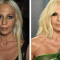 Majkl Džekson zamalo ostao bez nosa, a Donatela Versaće neprepoznatljiva: Ove poznate ličnosti su se pokajale zbog plastičnih…