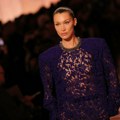 Nevidljiva bolest, ali stvarna borba: Bella Hadid ponovo na lečenju od lajmske bolesti Iz ugla web urednice: Kako izgleda…