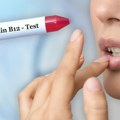 Usta su često prvo mesto na telu na kojem se vidi nedostatak vitamina B12