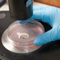 Epidemija leptospiroze u Sarajevu: Dva nova slučaja zaraze, ukupno 95