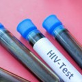 Poziv na besplatno i brzo HIV testiranje – bez zakazivanja