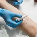 Potvrđen prvi slučaj alergije na crveno meso: Doktorka Plavšić objašnjava šta je alfa-gal sindrom i kako se leči?