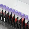 Ponovo radi Služba laboratorijske dijagnostike u Veterniku
