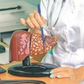 Zbog čega je sve više obolelih od masne bolesti jetre? Stručnjak objašnjava šta je najznačajnije za prevenciju i lečenje