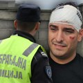 Saopštenje mupa povodom udesa Darka Lazića: Evo šta su sledeći koraci nakon što je izazvao saobraćajku i šta sada čeka pevača…