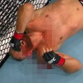Ух... ММА борац показао како му изгледа лице после језивог нокаута у Београду! Доктори су морали да га ушивају, погледајте…