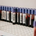AKCIJA DOBROVOLJNOG DAVANJA KRVI U UTORAK 17. JUNA