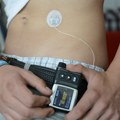 Velika promena za obolele od dijabetesa tipa 1: Država proširila izbor pomagala o trošku RFZO