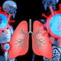 Da li je bronhitis, ili upala pluća? Simptomi su slični, evo po čemu da ih prepoznamo