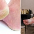 Melem za ispucale pete koji pravi čuda: Jeftin trik za savršeno glatka stopala