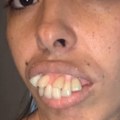 Promenila lični opis Devojka imala najružnije zube na svetu, a onda se udala za zubnog hirurga (video)