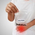 Kamen u žuči nije uvek bezopasan: Komplikacije mogu dovesti i do akutnog pankreatitisa, a prevencija je ključna
