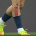 (VIDEO) Kvarachelija odrao kožu i prolio krv, PSŽ izjednačio!